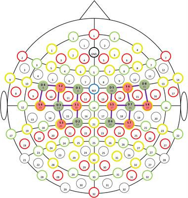 Exercise Prescription Improve the Rehabilitation of a Child With Viral Encephalitis Sequelae: A Case Report